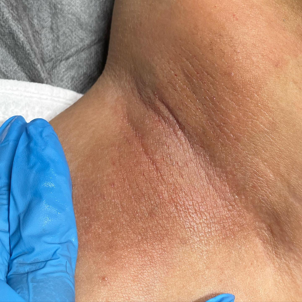 Under Arm Wax