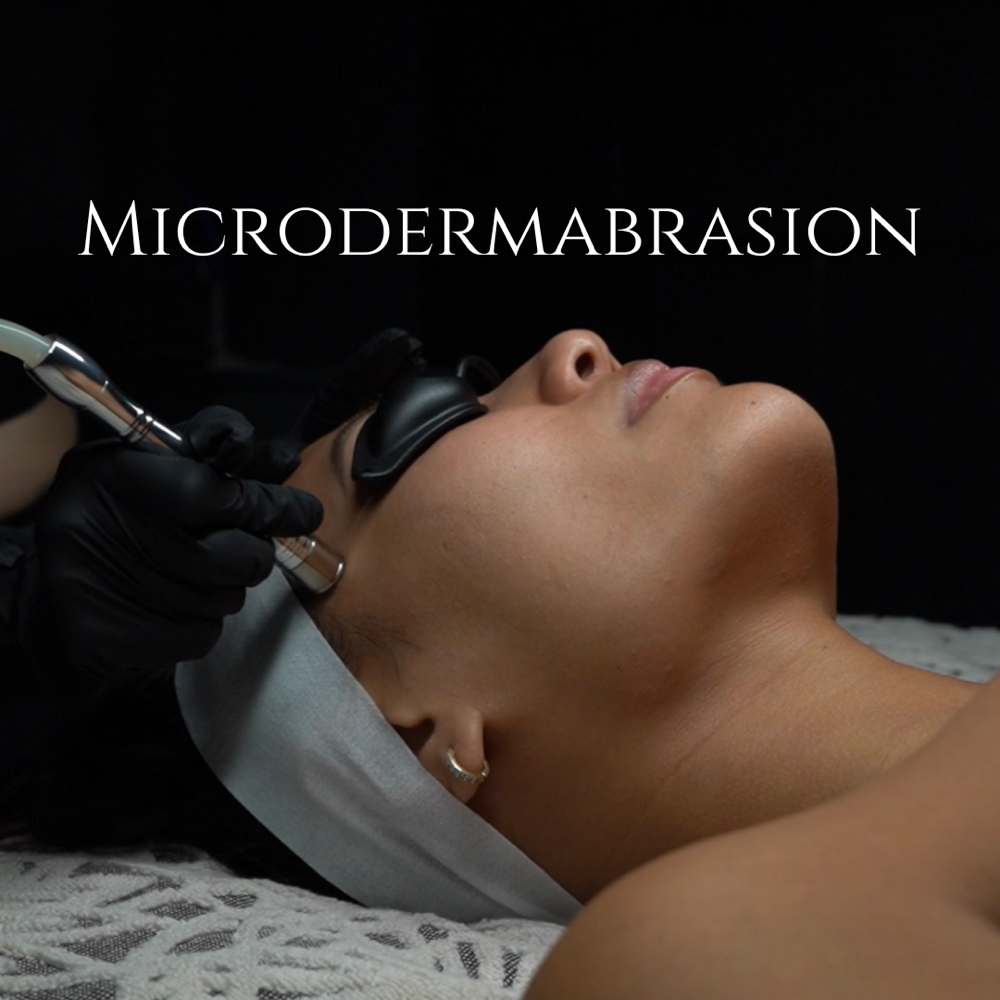 Microdermabrasion