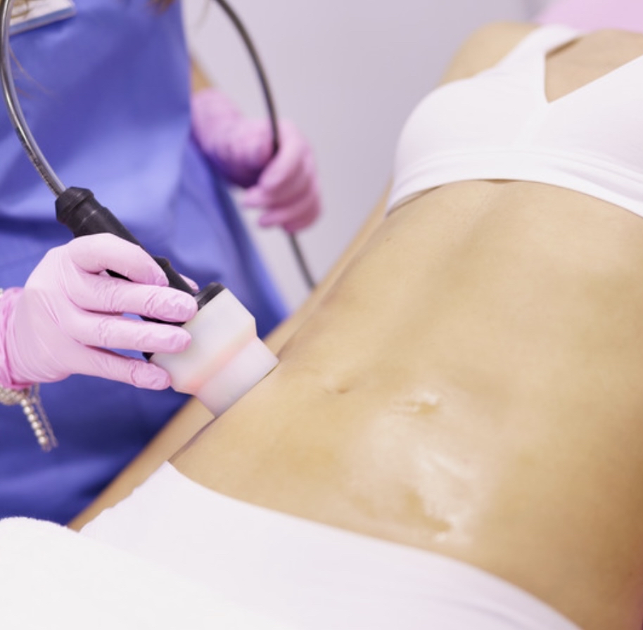 Body Sculpting/Post Op (6) Package at Vluxe Studio in Newcastle, WA