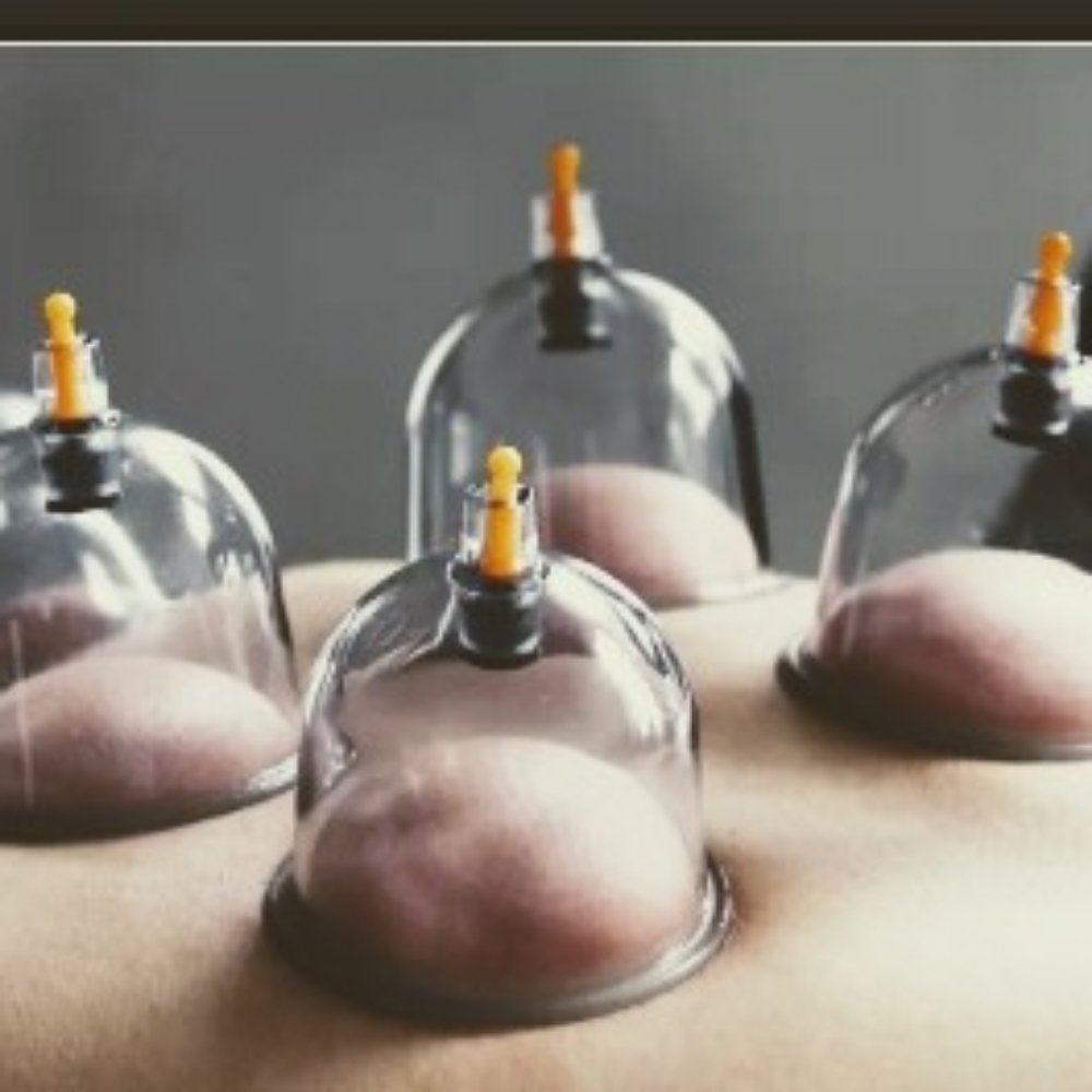 Cupping Therapy