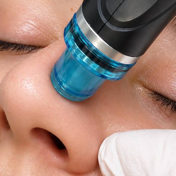 Hydradermabrasion at La VILNA in Jacksonville, FL