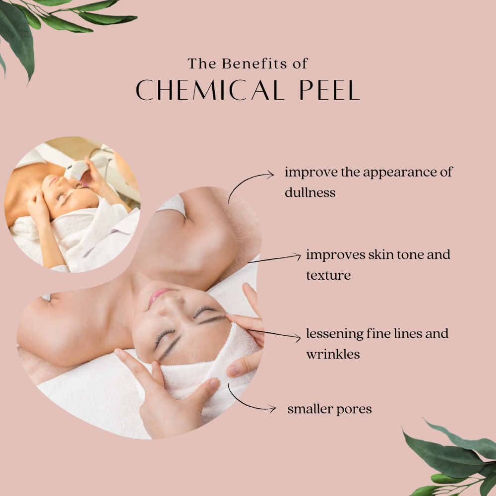 Facial with Chemical Peel. Level 2