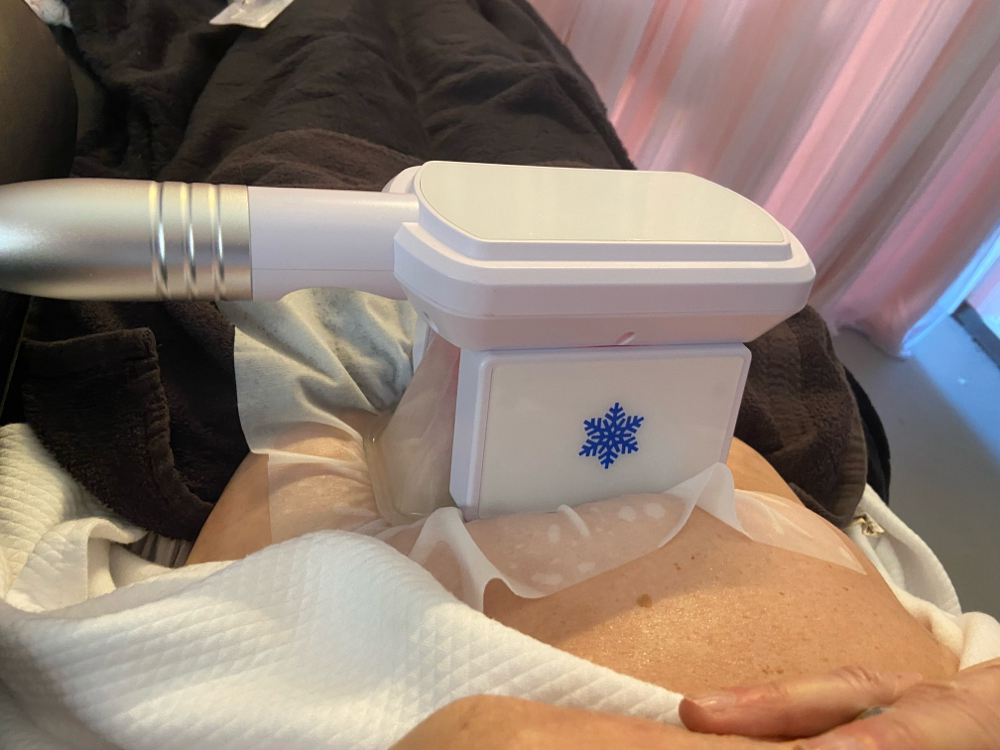 Fat Freezing