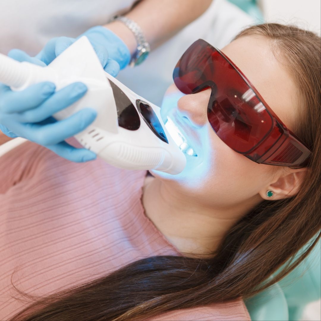 60 Min Teeth Whitening at CV Serenity Medspa in Mountainside, NJ