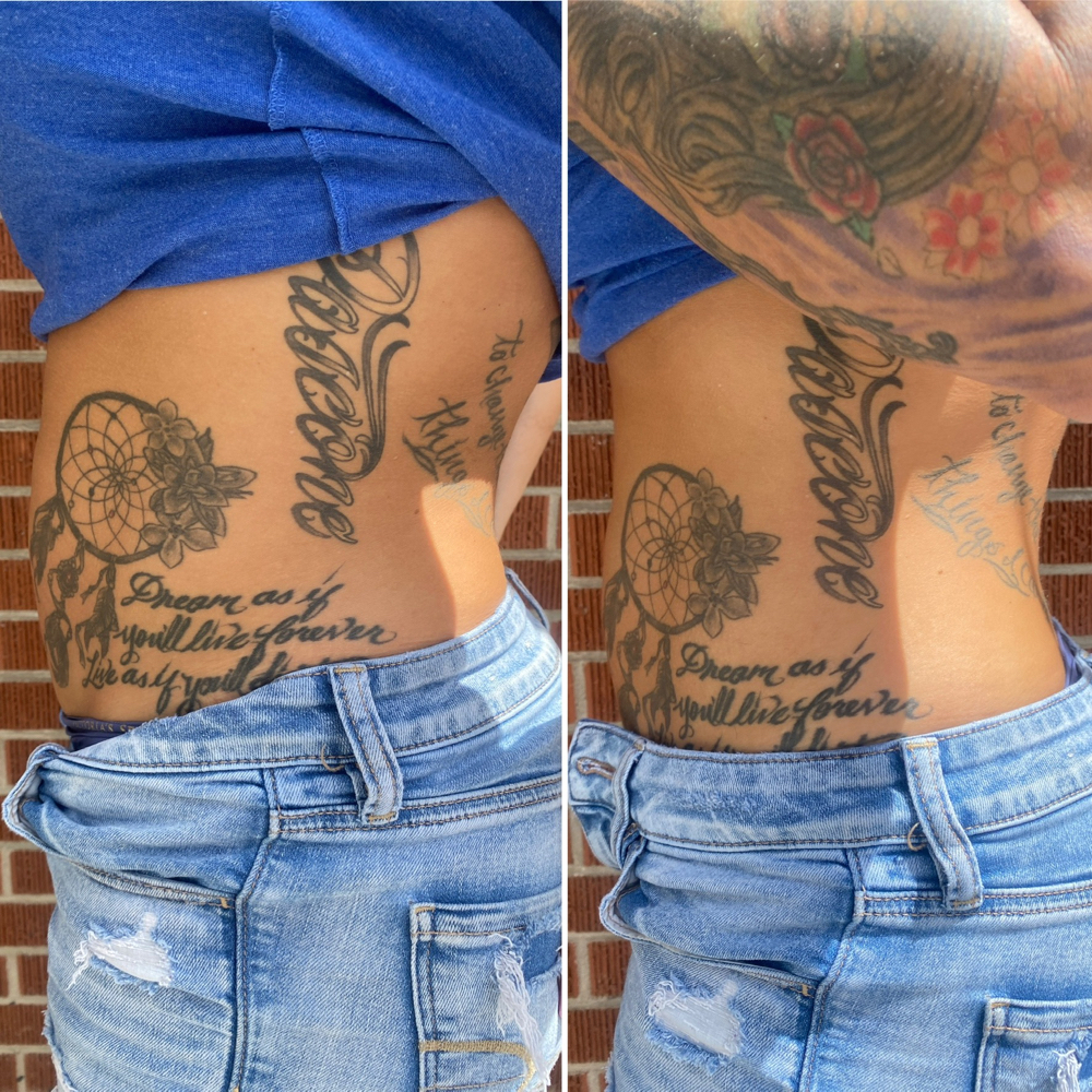 60 Min Lipo Cavi