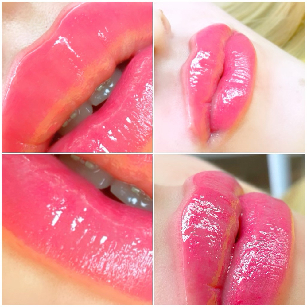 Lips Micropigmentation