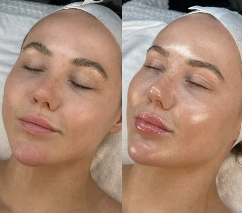 Divine Infusion Facial