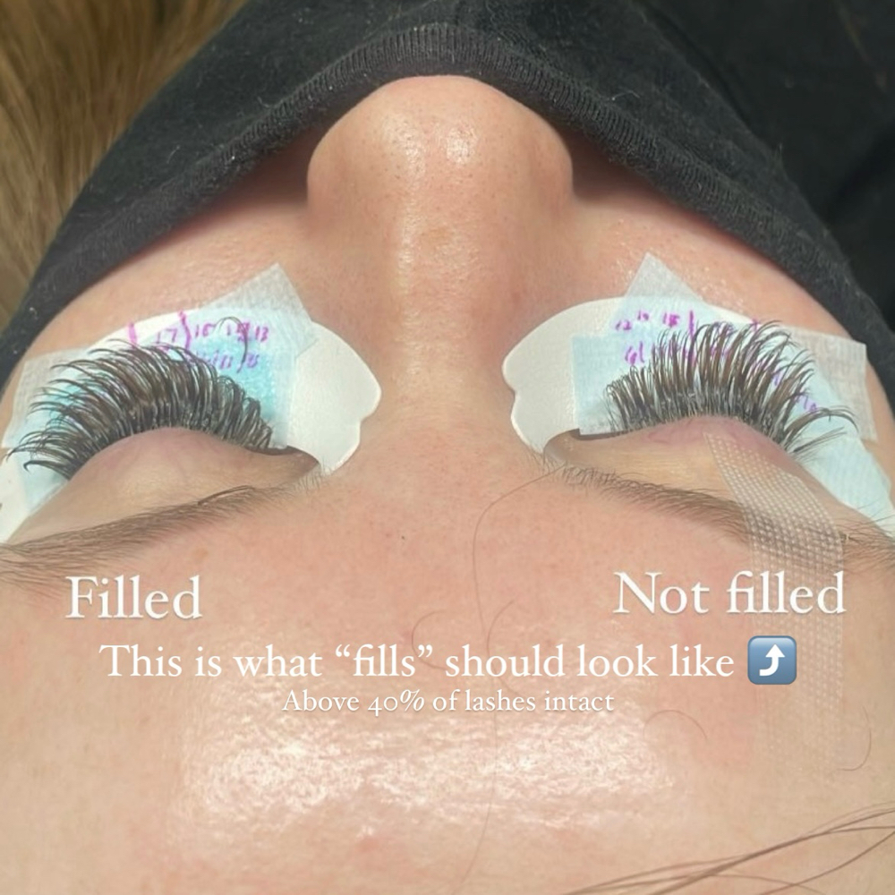 Mini fill (1 Week Or Less)