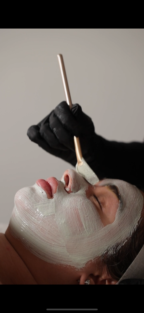 The Acne Facial