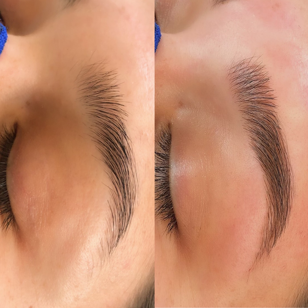 Microblading