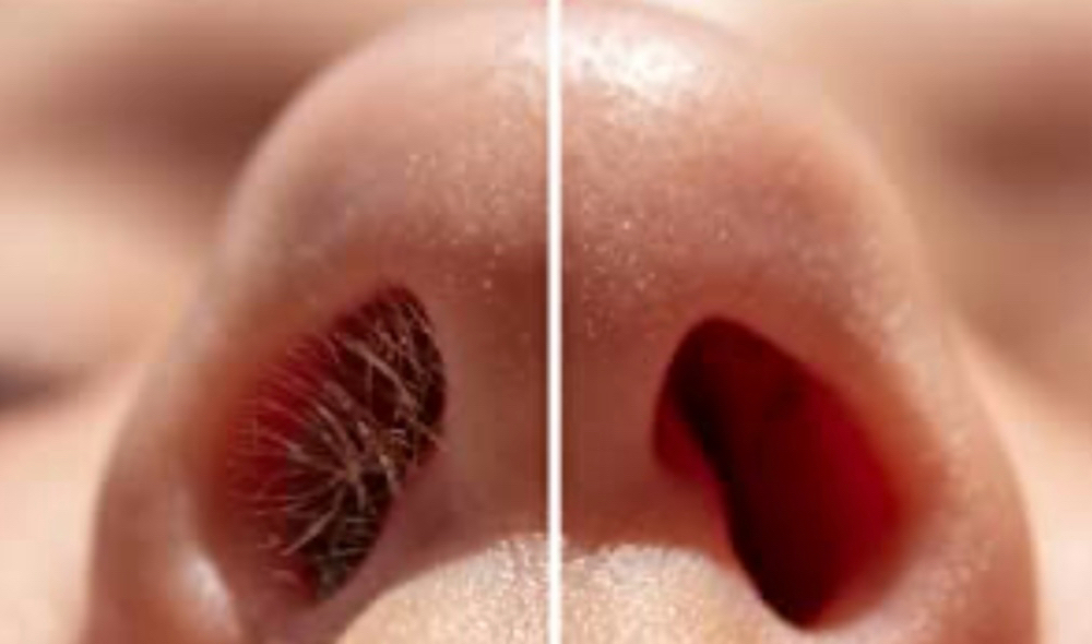 Nose Hair Wax