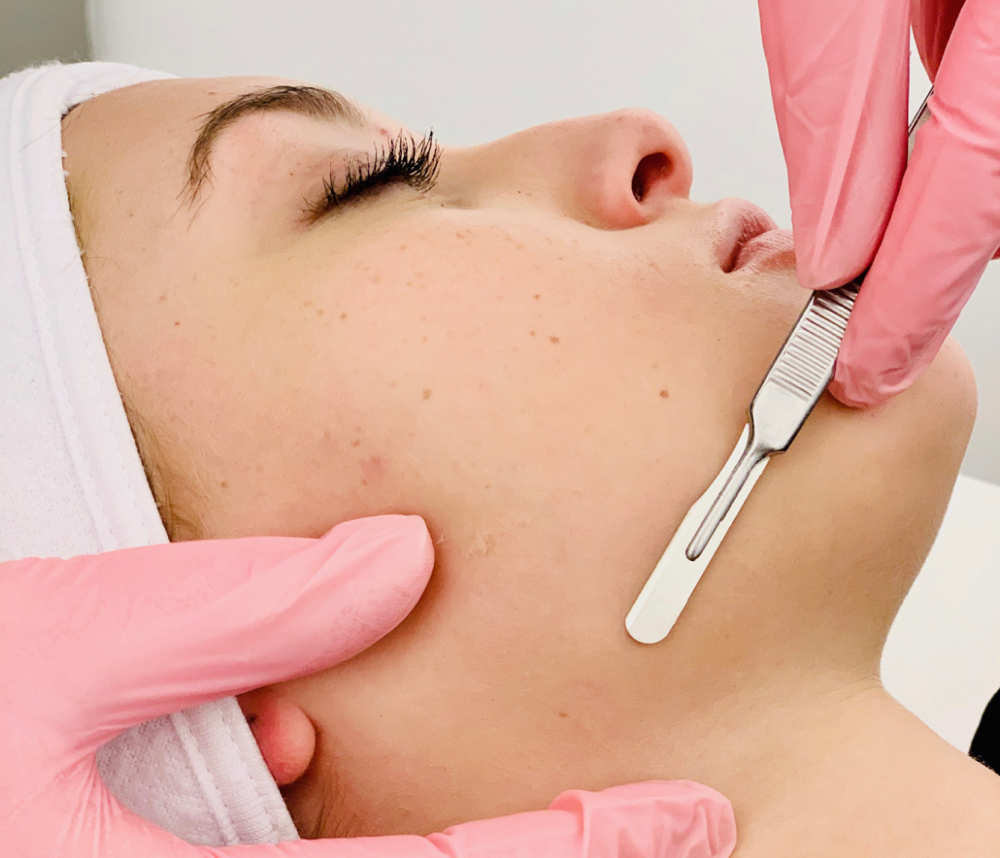 Dermaplane Facial