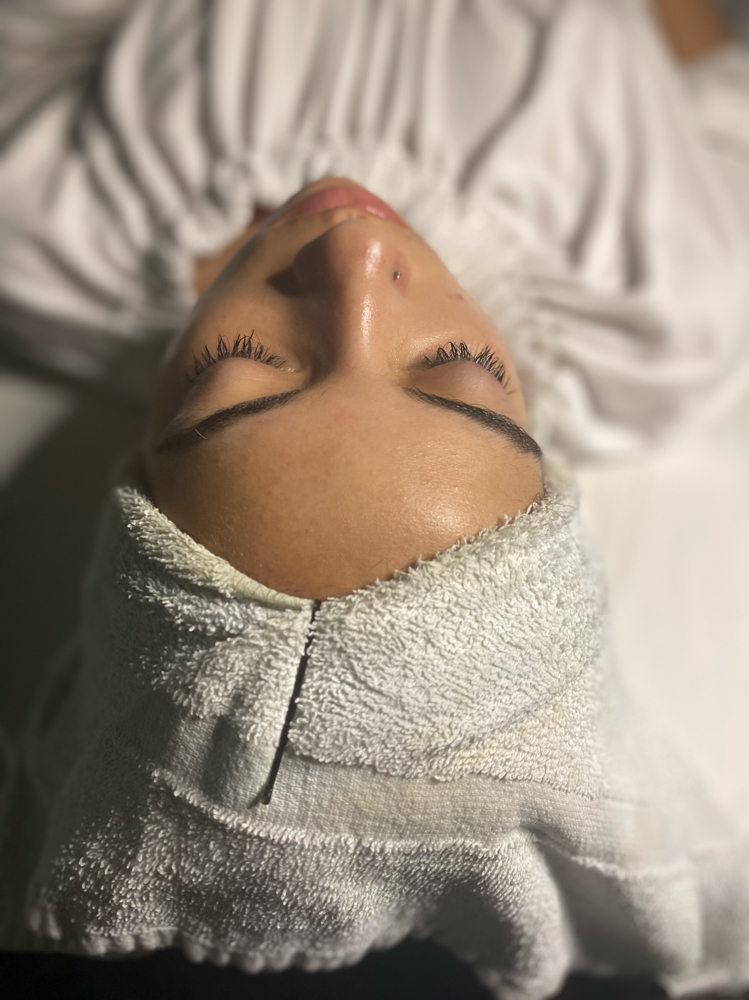 Microdermabrasion