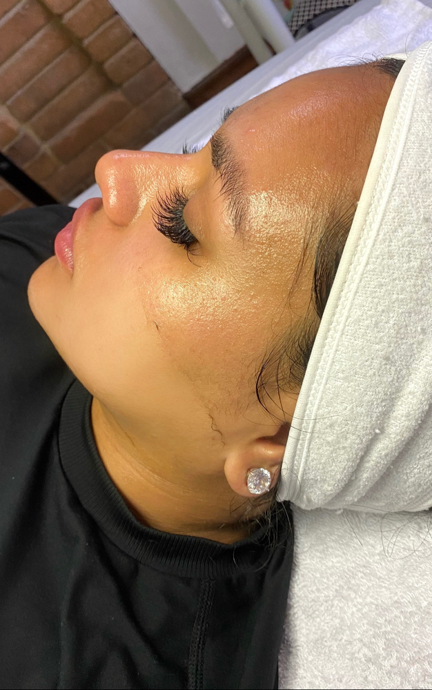 The Dermaplane Facial