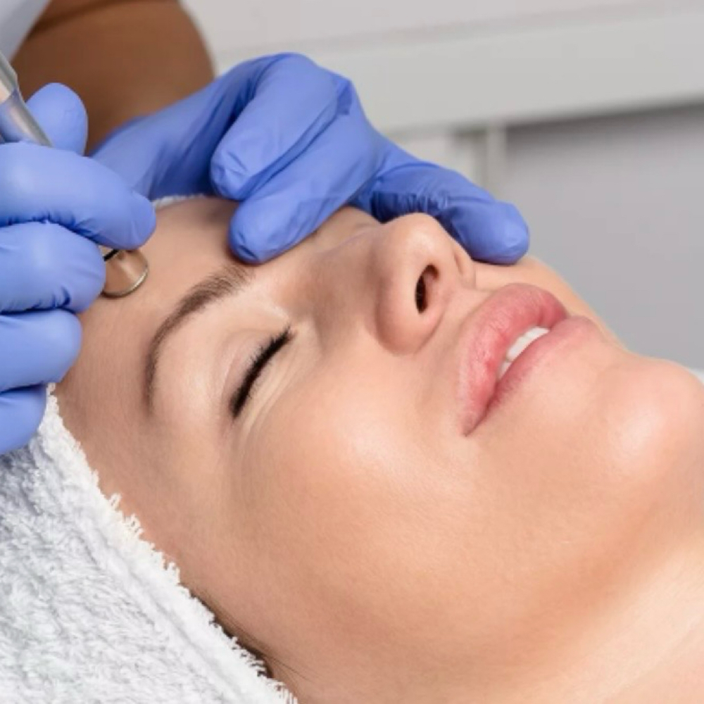 Microdermabrasion at Paris Beaute in Fresno, CA