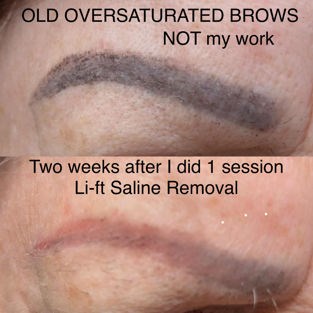 PMU Removal Old Work at Blue Ridge Beauty PMU in Marion, NC