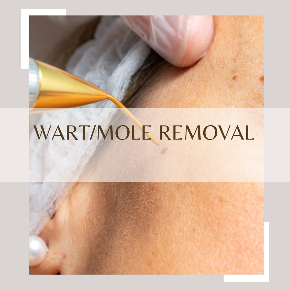 Wart / Mole Removal