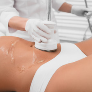 Ultrasonic Cavitation at Dreas Body Sculpting in Napa, CA