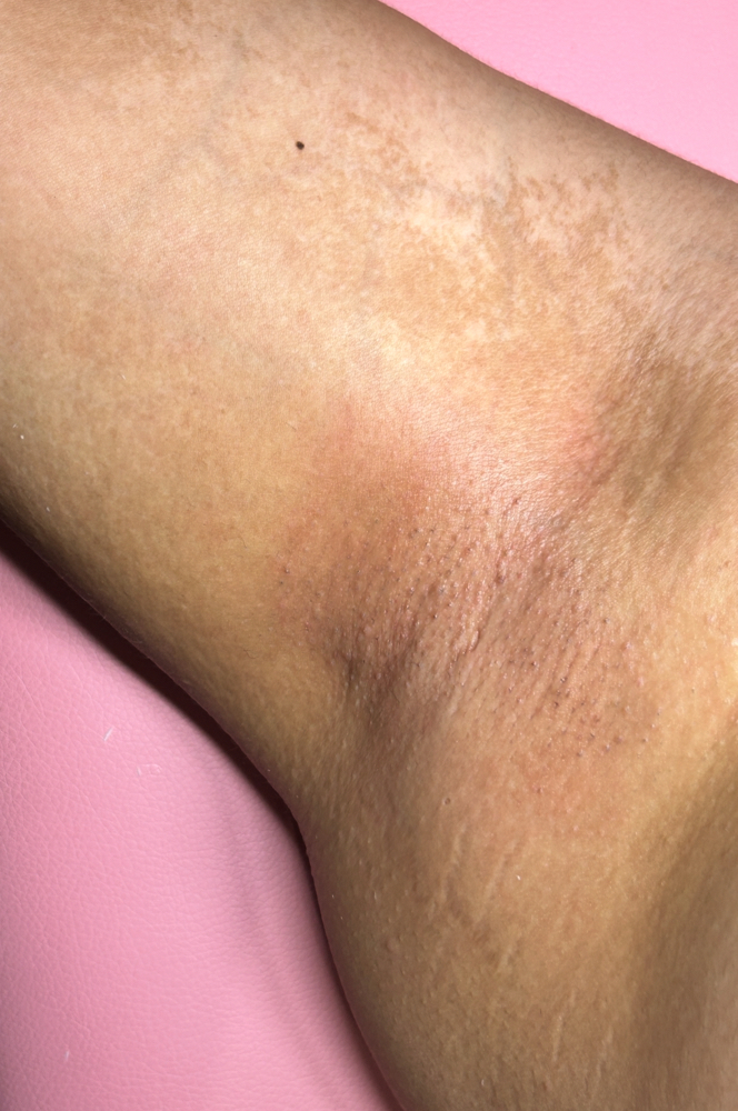 Underarm Wax
