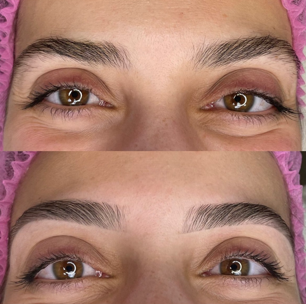 Strategic Brow Design