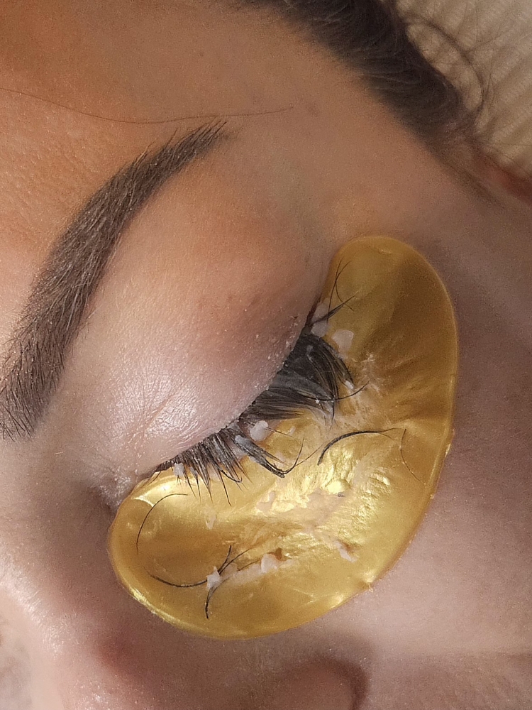 Extension Removal