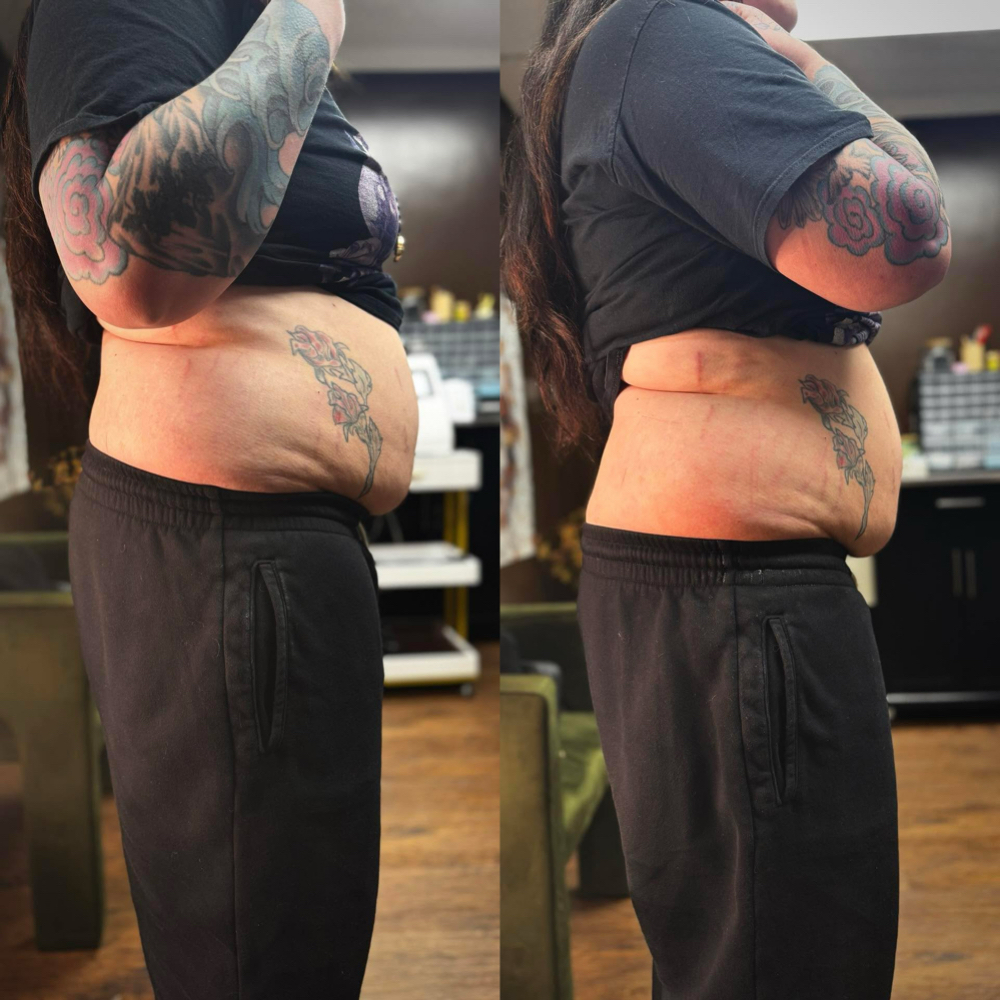 Slim Body Session at Body Art By Jess in Columbus, IN