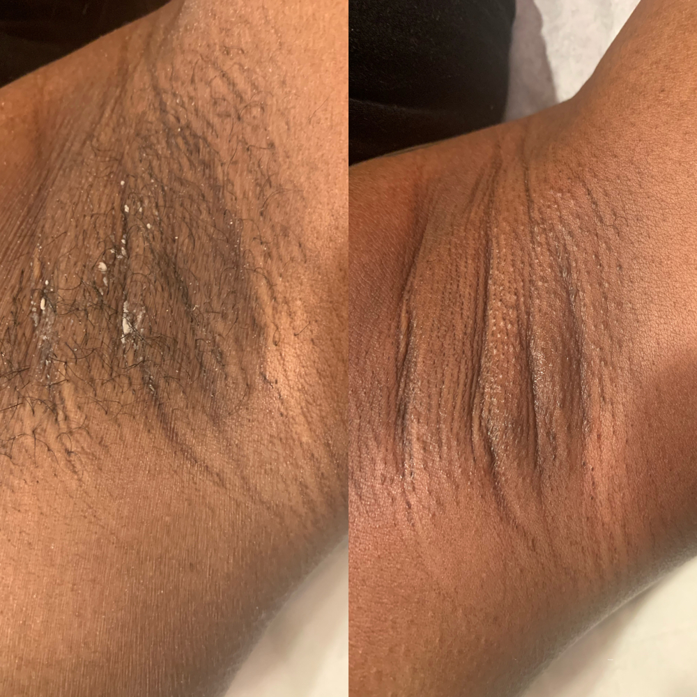 Underarm Wax
