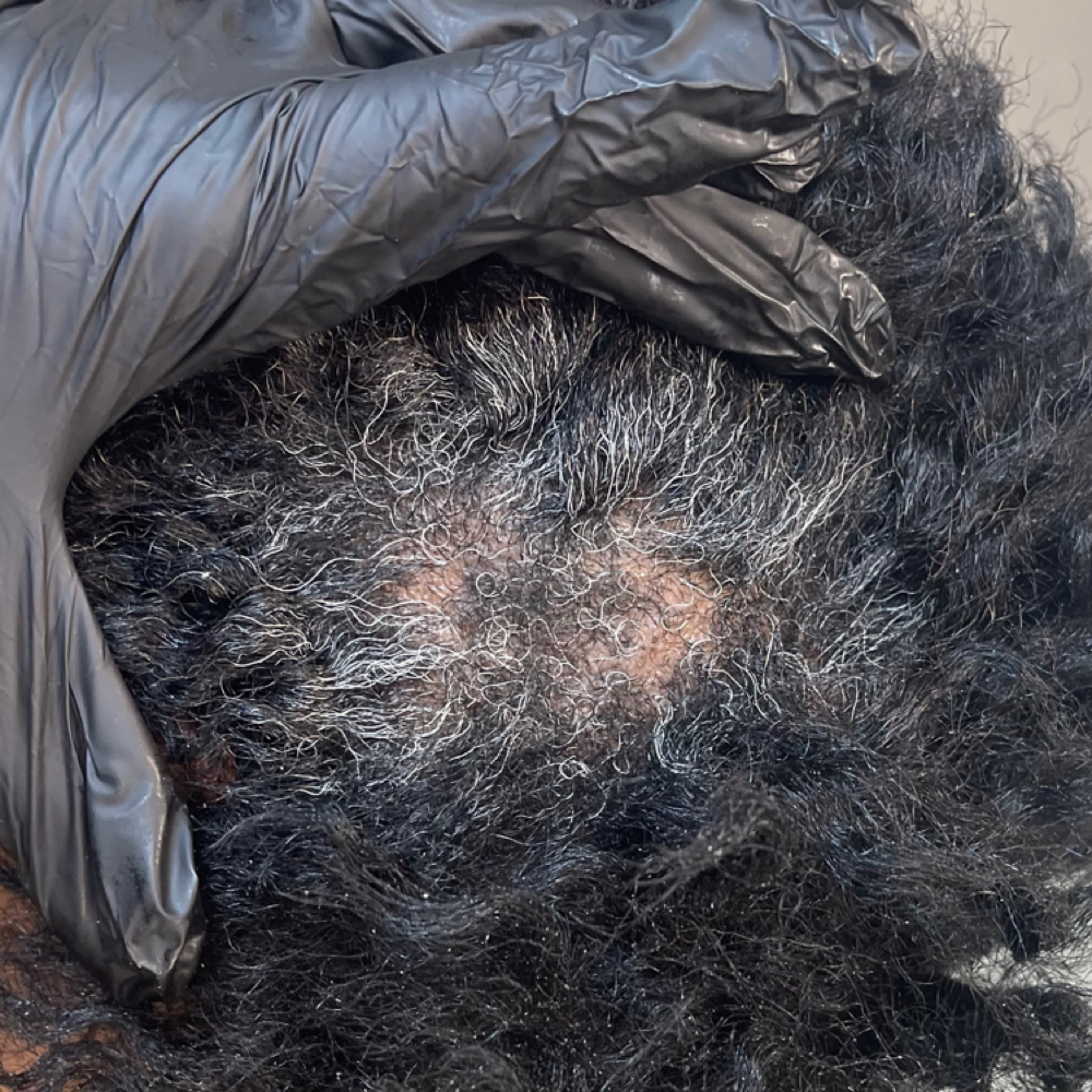 Trichology Scalp Analysis at Beauty by Kreme LLC in Buford, GA