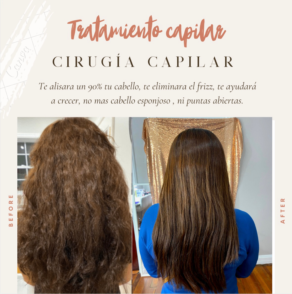 CIRUGIA CAPILAR TREATMENT