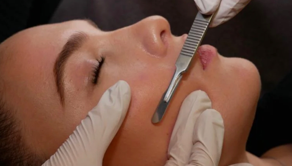 Dermaplane Facial