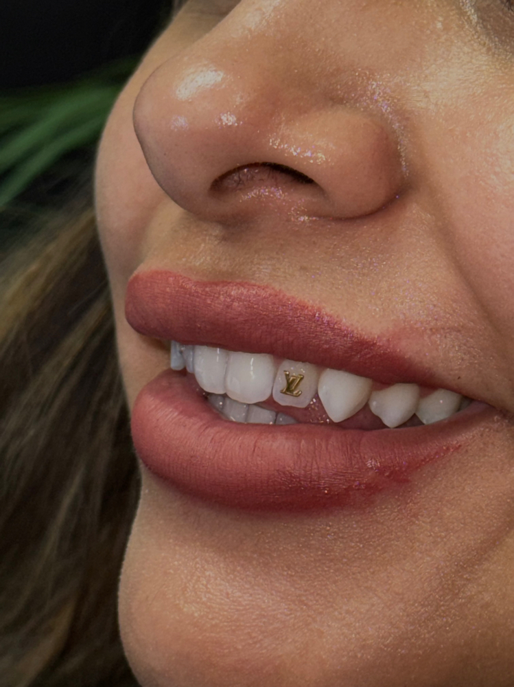 Gold Tooth Gems