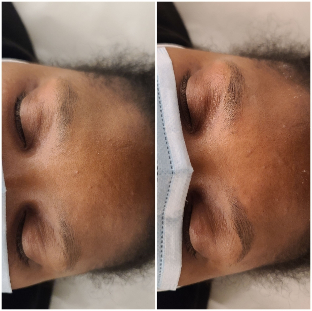 Eyebrow Wax
