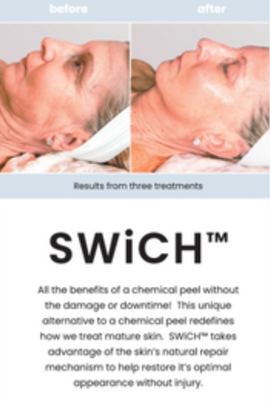 Swich Treatment