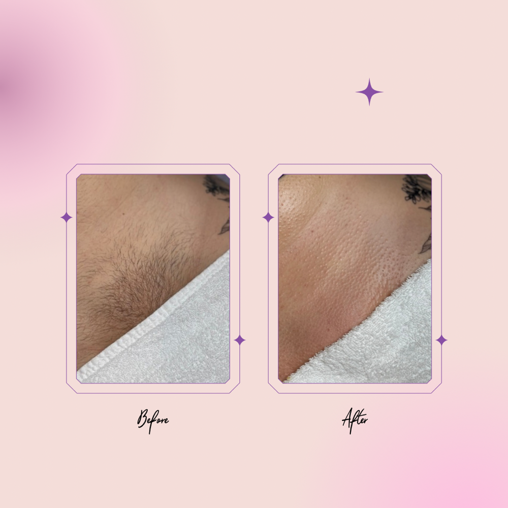 Brazilian Maintence (4-6 Weeks)