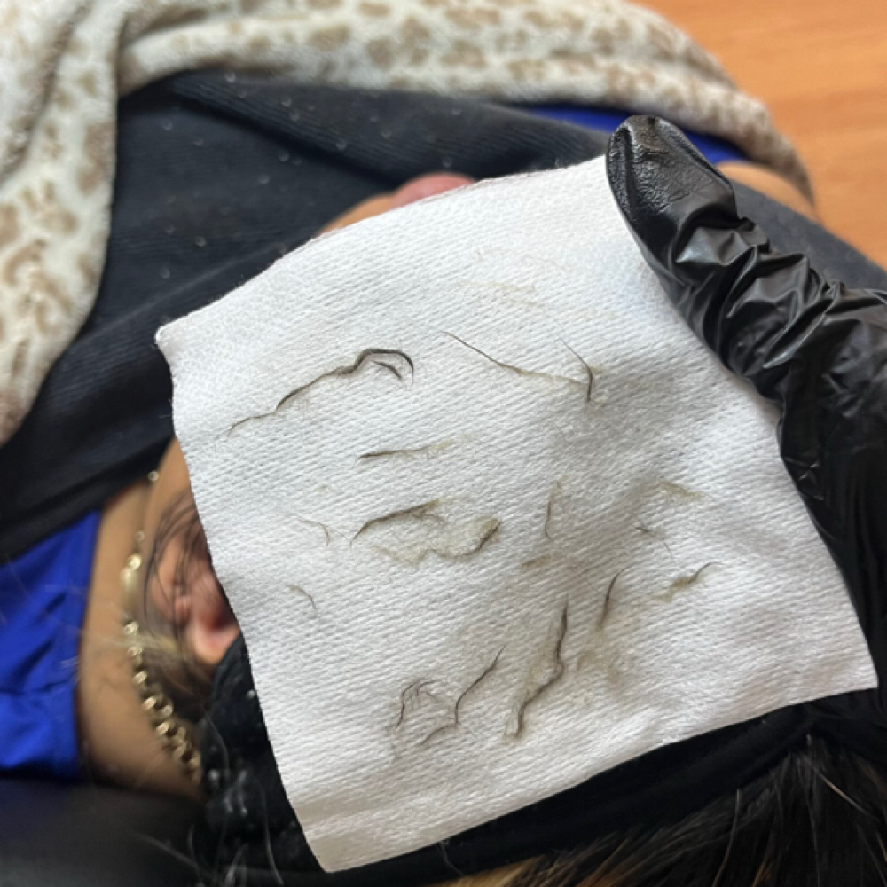 Dermaplane 60 min Facial at VNBeauty in Angelton, TX