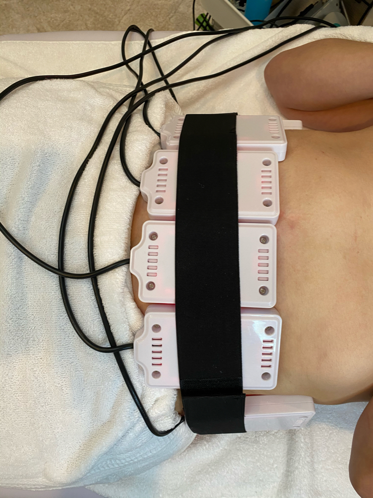 Lipo Laser non Invasive/cavitation at Dreas Body Sculpting in Napa, CA