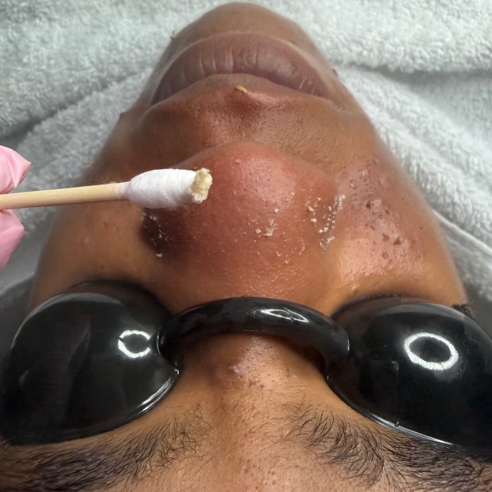 K8ER Custom Facial at K8ER in Akron, OH