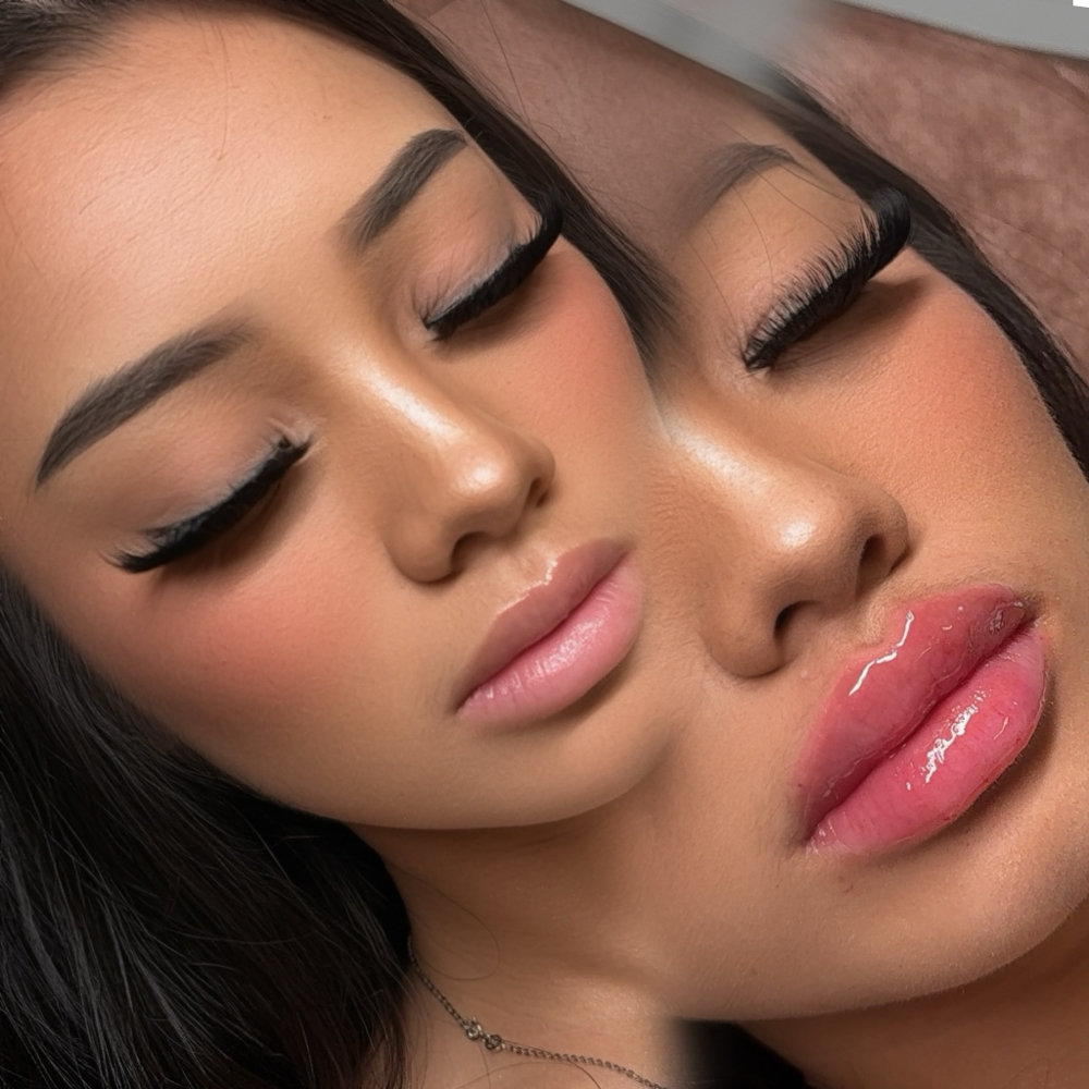 LIP FILLER at Opulence Beaute in Dunwoody Ga, GA