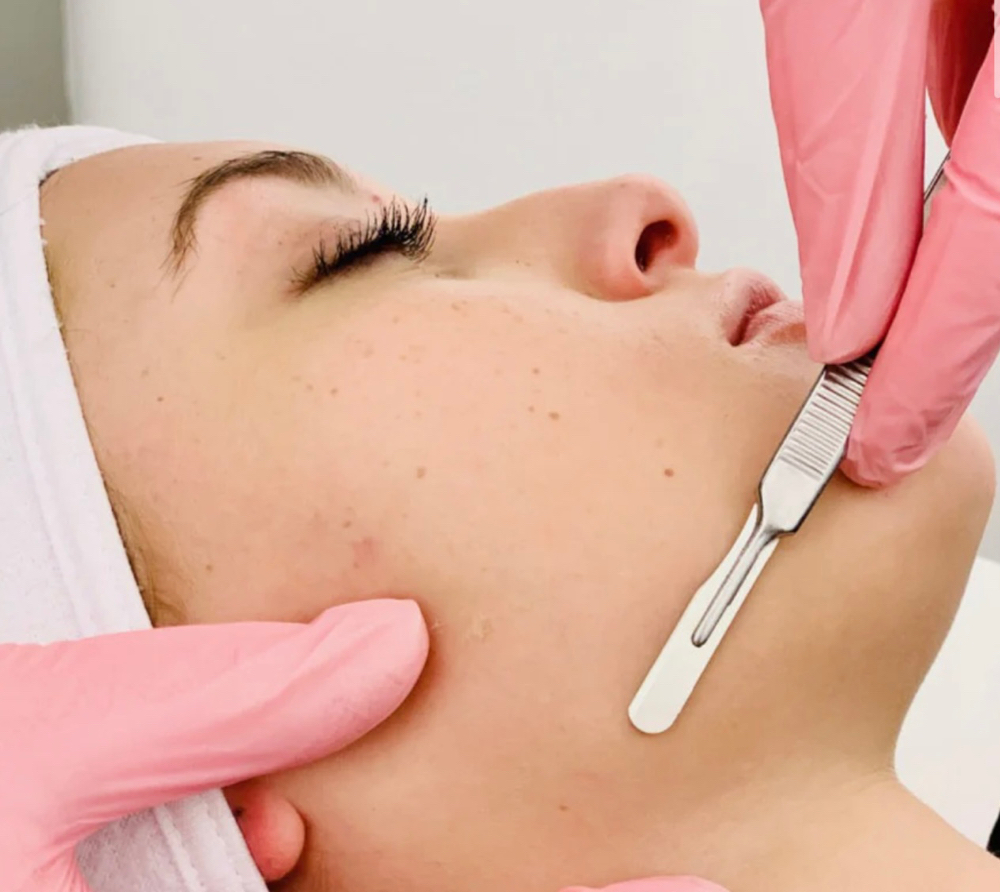 Dermaplaning Facial