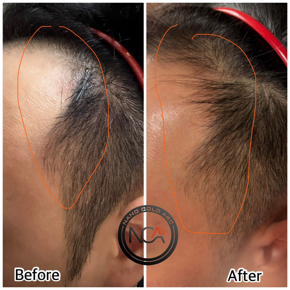Hair Growth at Excellent Nails By Sandy in California, CA