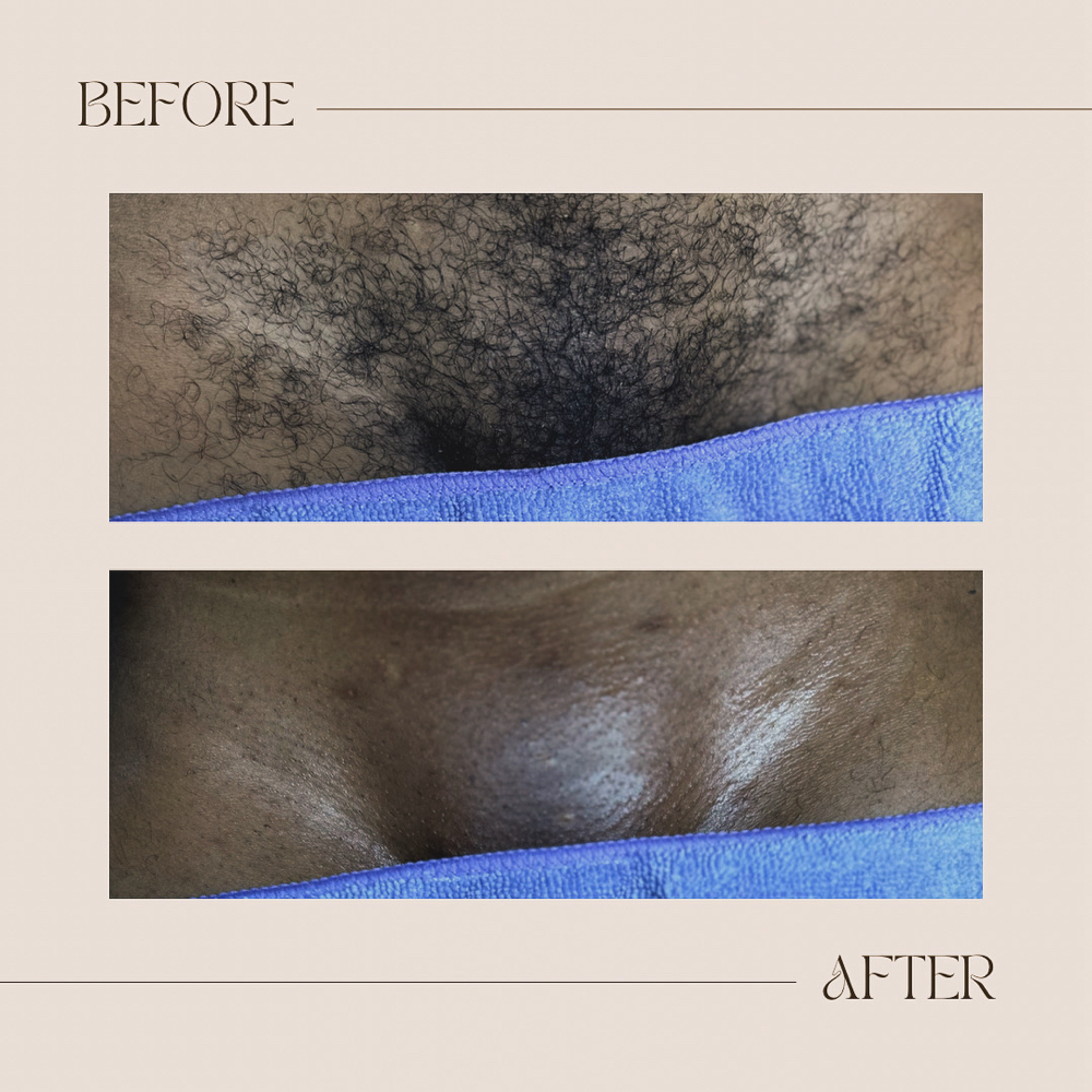 Brazilian Wax at Glam’d By Tierra Maenise in Kelford, NC