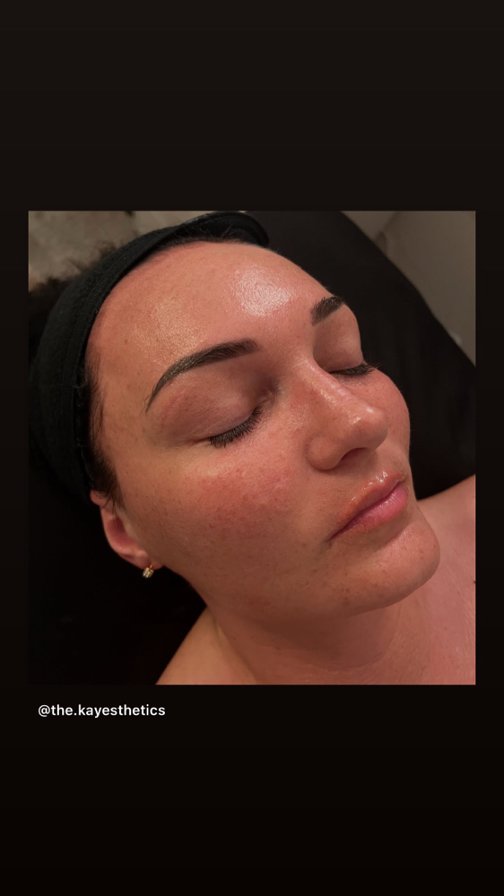 Firming Facial