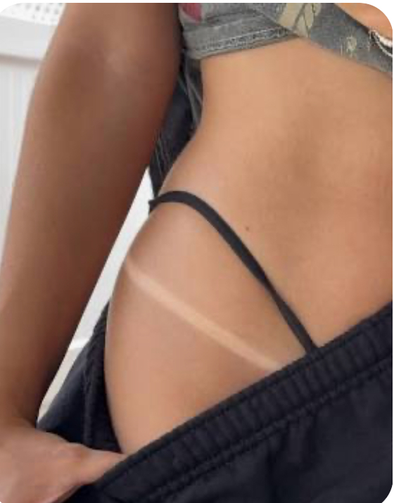 Spray Tan