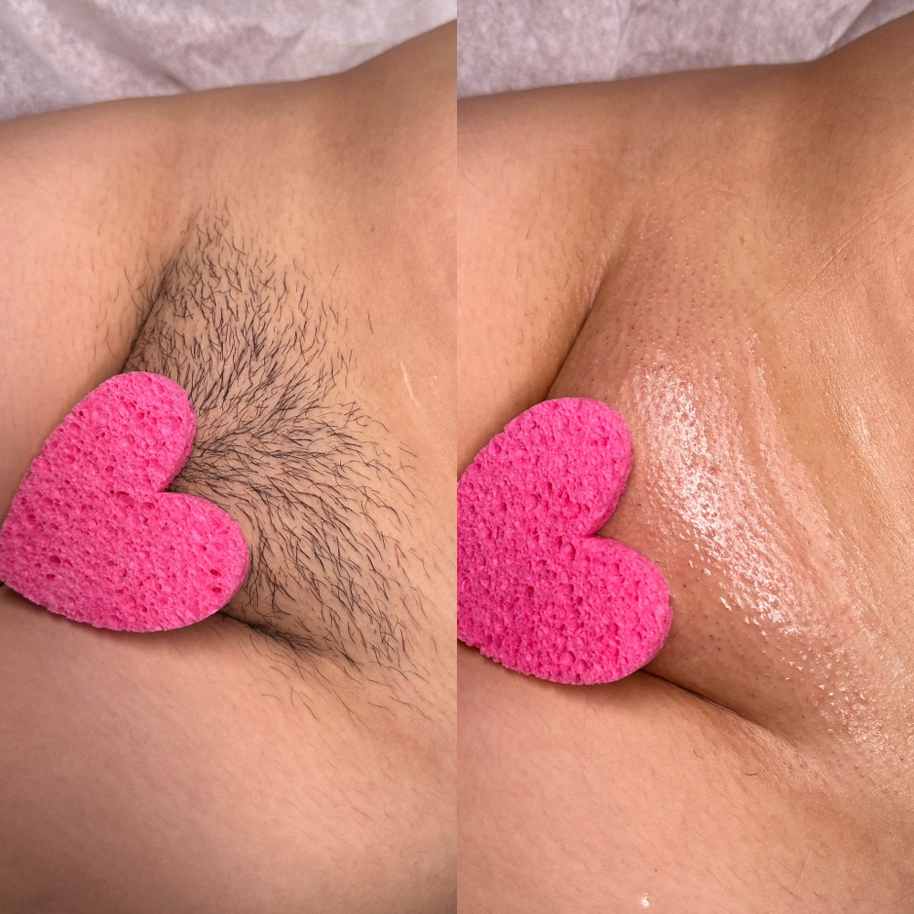 Brazilian Wax