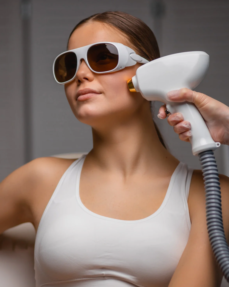 Depilacion Laser Seguimiento