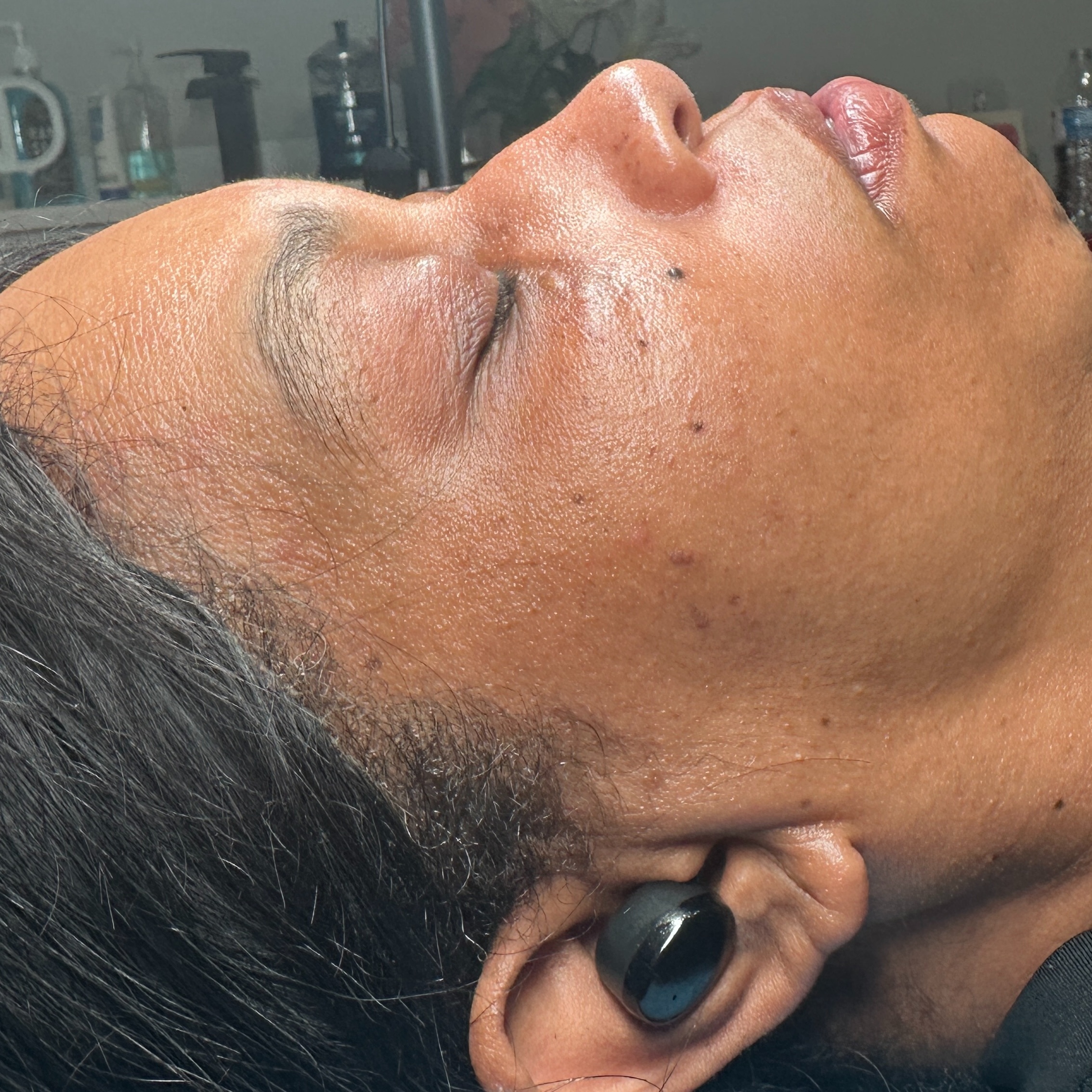 The Smooth Operator - Dermaplaning at Skin Rehab in Charlotte, NC