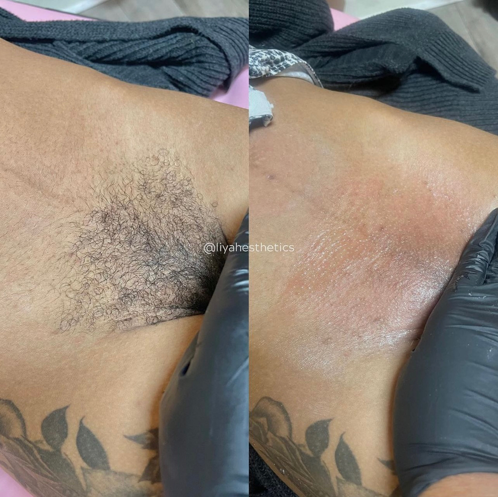 4 Week Brazlian