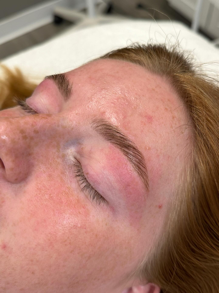 Brow Lamination
