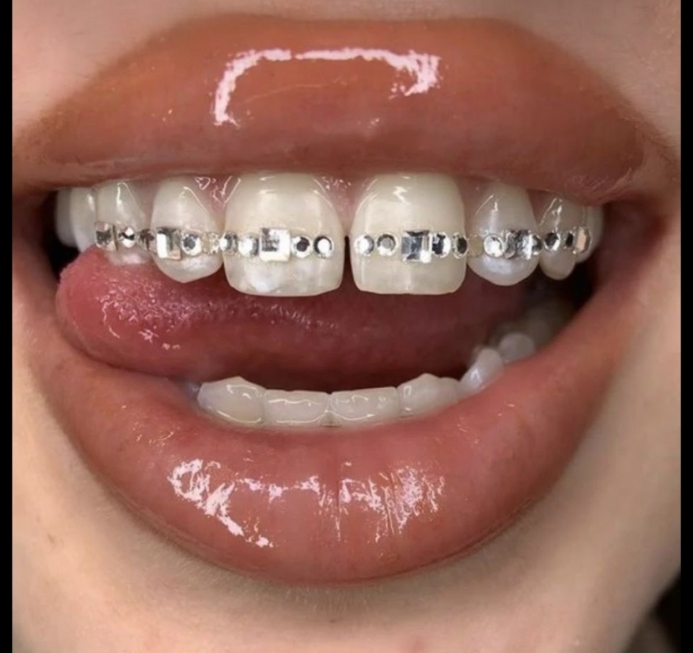 Tooth Gem at Lux Aesthetics in Rockford, IL
