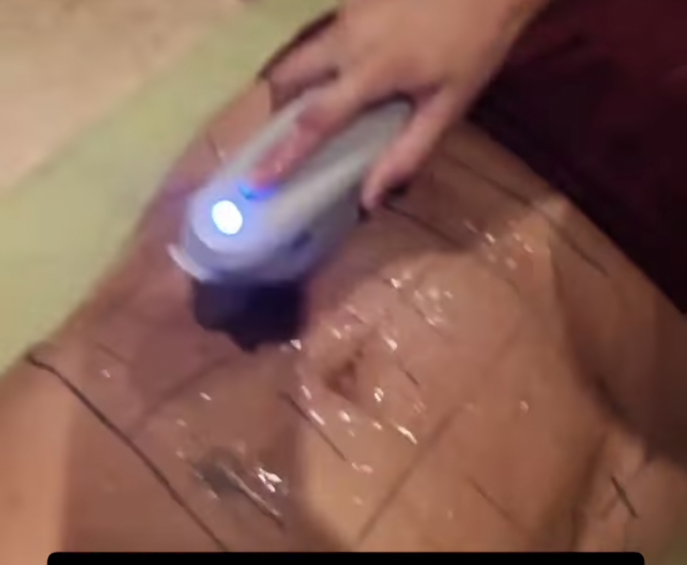 High Intensity Ultrasound- HIFU